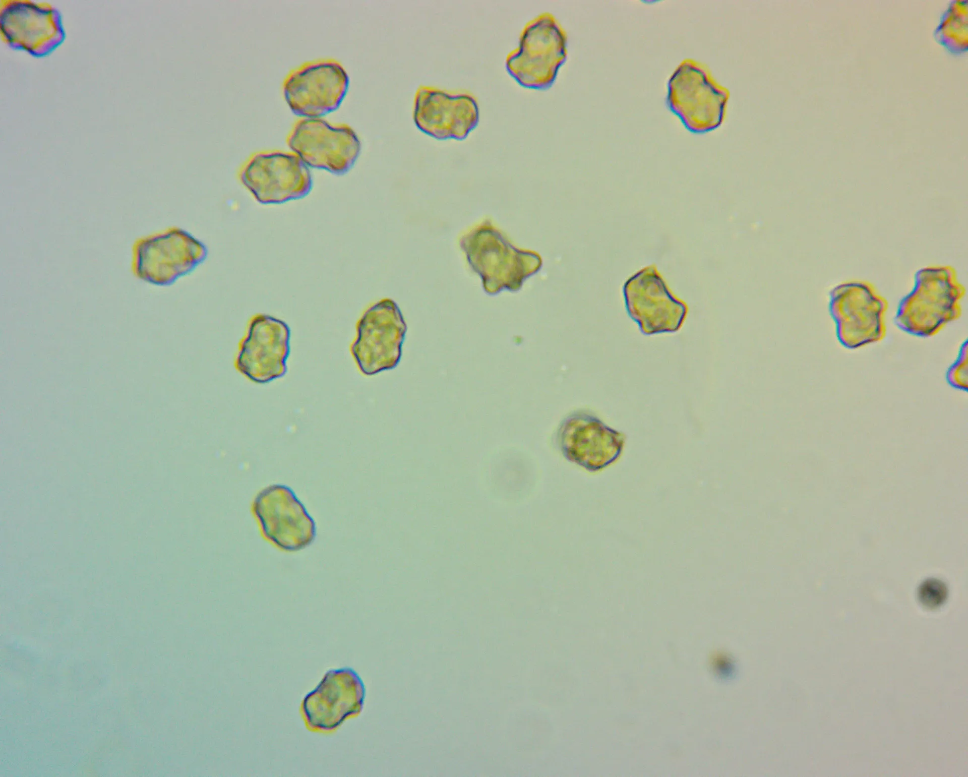 Microscopía de Inocybe bresadolae - esporas (1)